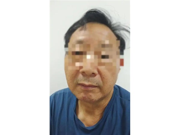 在面瘫恢复过程中，患者可以做些什么来加速康复或减轻症状？